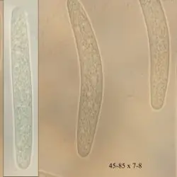 Cryptosporella suffusa (Fr.) L.C. Mejía & Castl. (1 de 2)