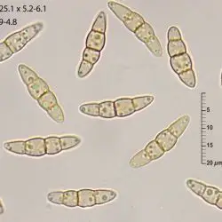 Leptosphaeria haematites (Roberge ex Desm.) Niessl (2 de 3)
