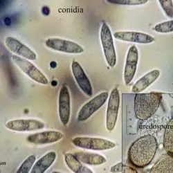 Fotografía Sphaerellopsis filum (Biv.) B. Sutton (2 de 3)