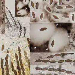 Fotografía Anthostomella leptospora (Sacc.) S.M. Francis (3 de 3)