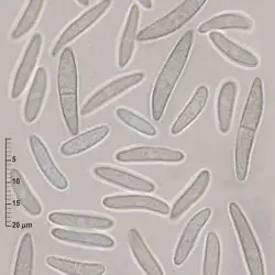 Cyathicula hysterioides (Rehm) E. Mll. (2 de 3)
