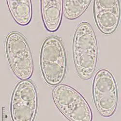 Pachyella peltata Pfister & Cand. (3 de 3)