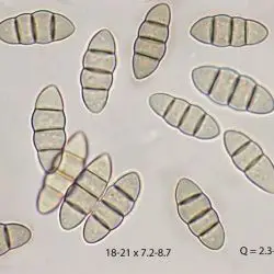 Plenodomus libanotidis (Fuckel) Gruyter, Aveskamp & Verkley (2 de 3)