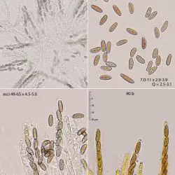 Fotografía Anthostomella punctulata (Roberge ex Desm.) Sacc. (3 de 3)