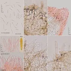 Fotografía Microscypha arenula (Alb. & Schwein.) Svrček (3 de 3)