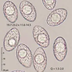 Neottiella albocincta (Berk. & M.A. Curtis) Sacc. (3 de 3)