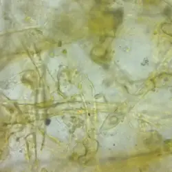 Saccorhiza polyschides (3 de 3)