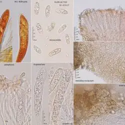 Pezicula frangulae (Pers.) Fuckel (3 de 3)