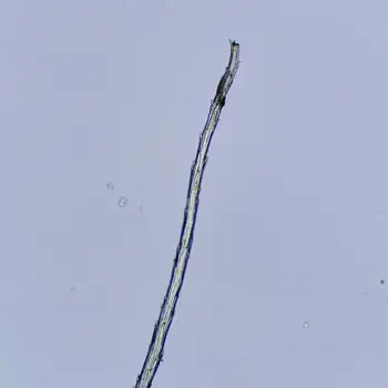 Grimmia pulvinata (2 de 6)