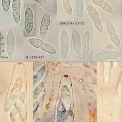 Plagiostoma aesculi (Fuckel) Sogonov (2 de 3)
