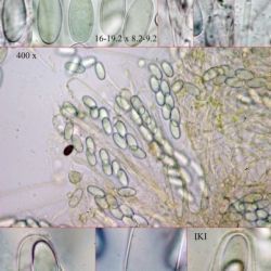 Coprotus leucopocillum Kimbr., Luck-Allen & Cain  (2 de 2) 