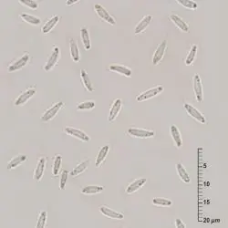 Psilachnum chrysostigmum (Fr.) Raitv. (2 de 3)