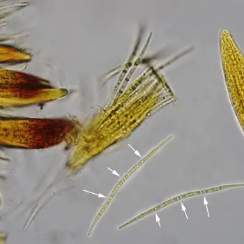 Neolamya peltigerae (Mont.) Theiss. & Syd. (5 de 6)