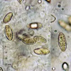 Fotografía Leccinum crocipodium (Letell.) Watling (2 de 3)
