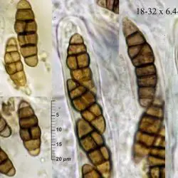 Pleospora vitalbae (De Not.) Berl. (2 de 2)