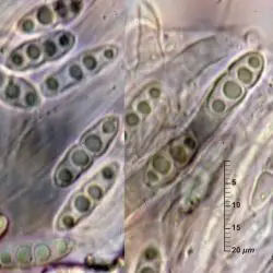 Lophiostoma nucula (Fr.) Ces. & De Not. (1 de 2)