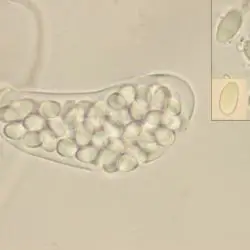 Thelebolus crustaceus (Fuckel) Kimbr. (1 de 3)