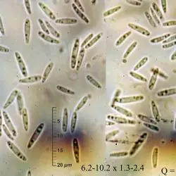 Psilachnum lanceolatoparaphysatum (Rehm) Höhn. (2 de 3)