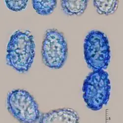Scutellinia pennsylvanica (Seaver) Denison (1 de 2)