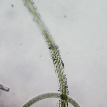 Coleofasciculus chthonoplastes (1 de 3)