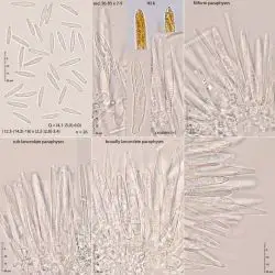 Cenangiopsis chlorospleniella (Rehm) Dennis (3 de 3)