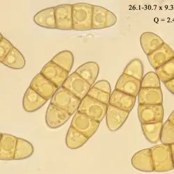 Lophiostoma quadrinucleatum P. Karst. (1 de 3)