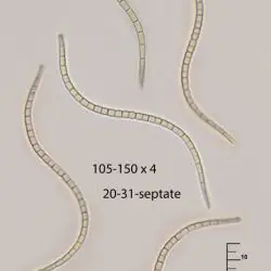 Ophiobolus constrictus E. Müll. (2 de 3)