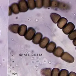 Sporormiella corynespora (Niessl) S.I. Ahmed & Cain (1 de 2)
