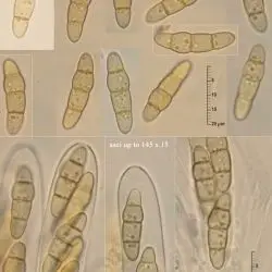 Phaeosphaeria eustoma (Fuckel) L. Holm (3 de 3)