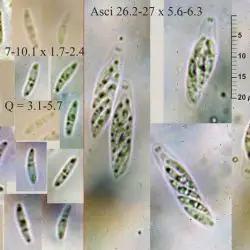 Gnomoniopsis tormentillae (Lind) Sogonov (2 de 3)